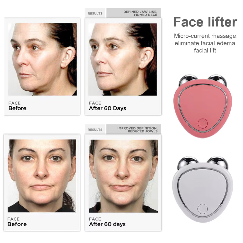 Masajeador Facial Con Microcorriente