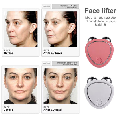 Masajeador Facial Con Microcorriente