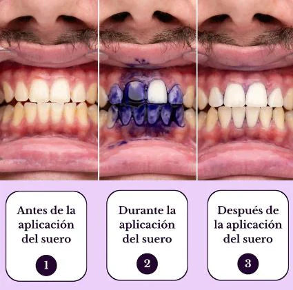 PASTA DENTAL BLANQUEADORA OBSESSIVE   50ML